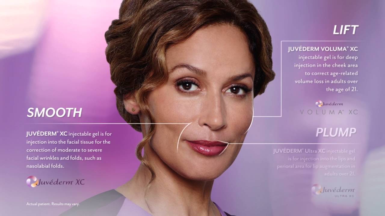 Juvederm Fort Lauderdale