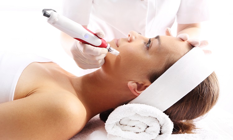 Microneedling Fort Lauderdale